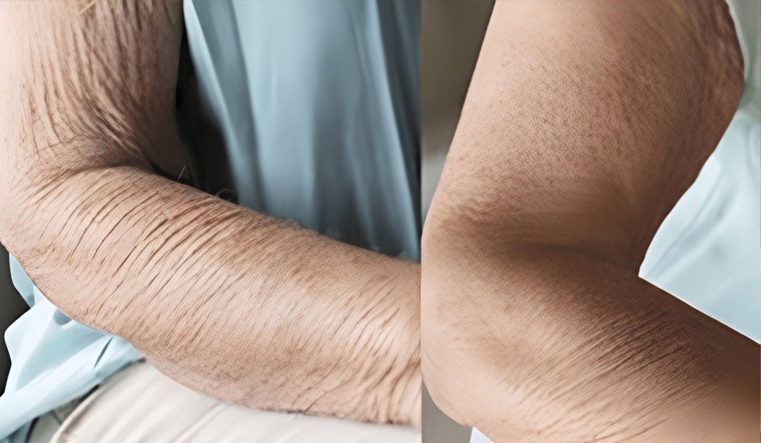 495574598 1103176975180210 1493552565037312545 n 1