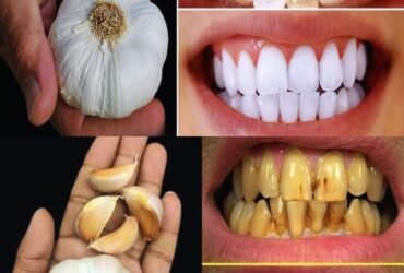 518276878 624004374070587 618068 1229x1536 1