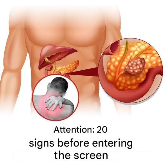 20 early signs that your body is fighting cancer 25 13298098 eb0d 4a1d 8b93 777f21a2a33e