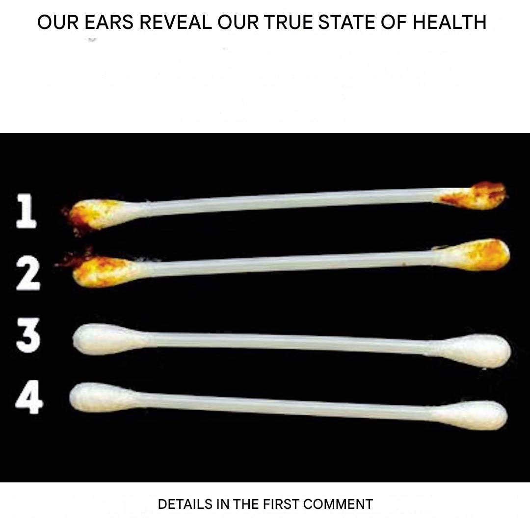 Our ears reveal our true state of health 25 IMG 20260124 WA0002